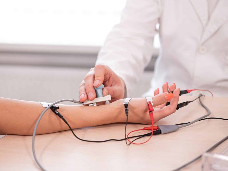 NerveConductionStudies