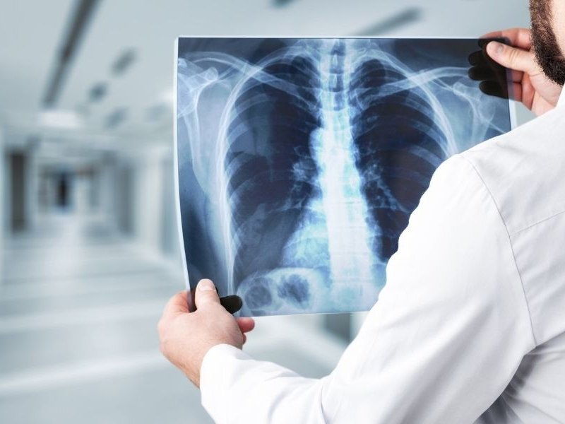 X-rays
